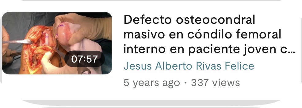 Vista previa del vídeo sobre defecto osteocondral masivo