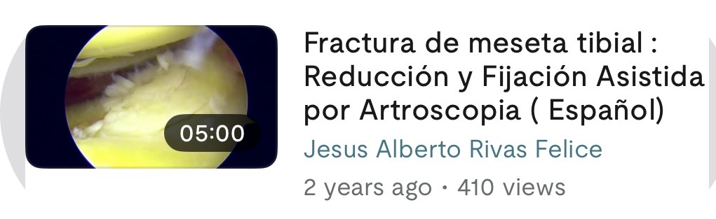 Vista previa del vídeo sobre fractura de meseta tibial